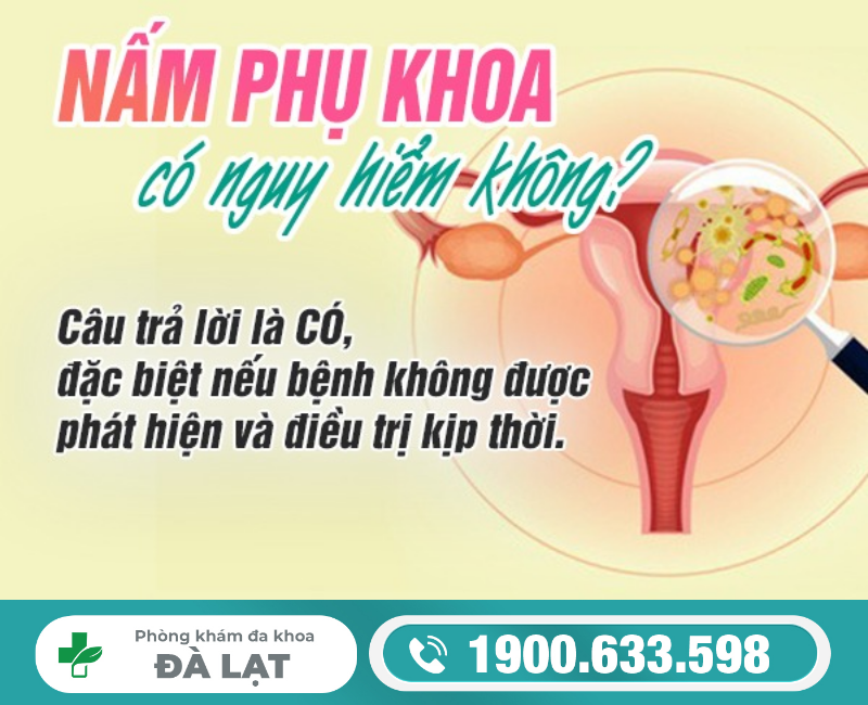 Hình ảnh minh họa